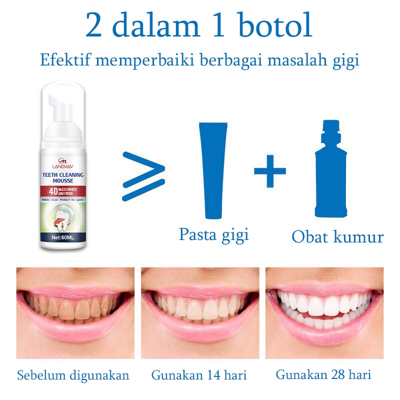 Pasta gigi whitening Gigi putih Whitening toothpaste Pasta gigi pemutih gigi Odol pemutih gigi dan karang gigi Mousse Pemutih Gigi Pembersih Mulut Pasta Gigi Berbusa Nafas Segar Menghilangkan plak dan gigi berlubang