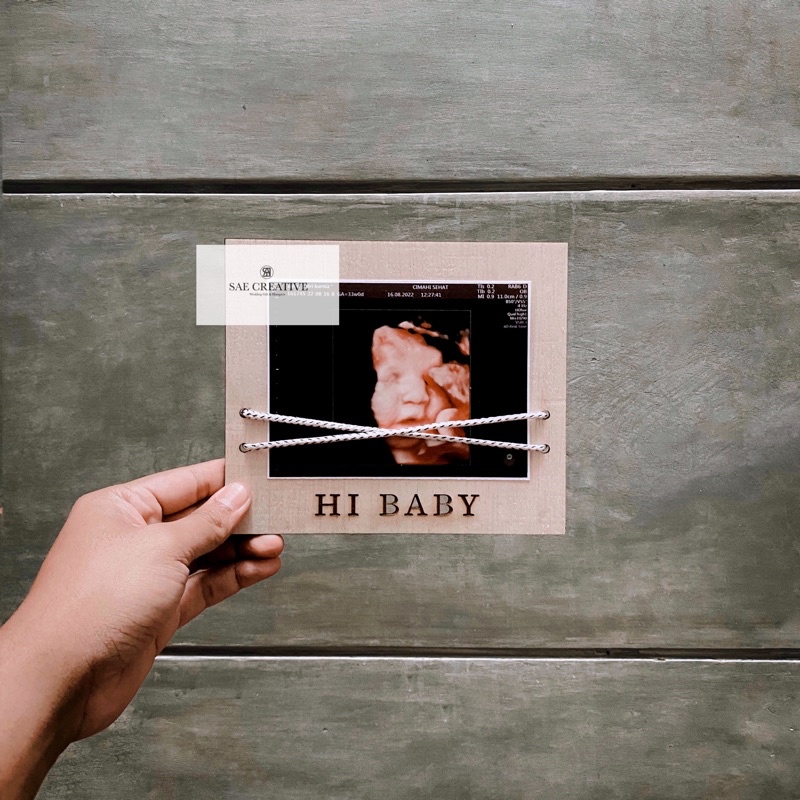 Photo Board | Baby Photo Frame | property foto maternity