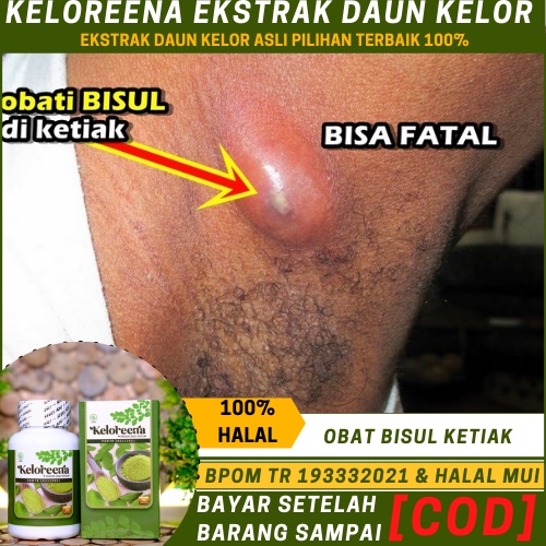 Obat Bisul Di Ketiak, Benjolan Nyeri Di Ketiak, Bisul Di Ketiak Tanpa Mata,   Pengempis Bisul Di Ket