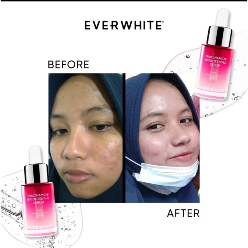 EVERWHITE Serum Series | Cica Soothing | Chromabright | Niacinamide | Aha Bha |Multi Action |Peptide