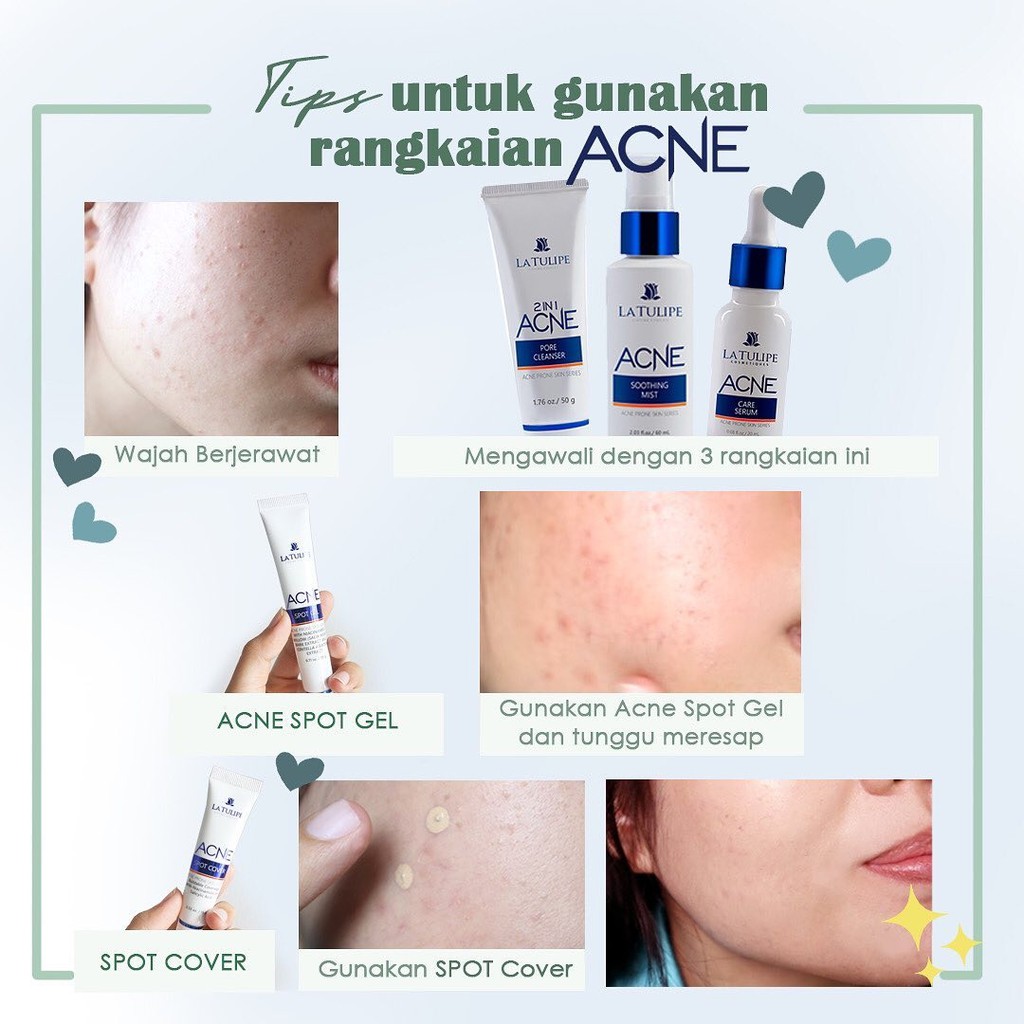 LA TULIPE ACNE SERIES [ECER] Lotion | Spot Gel | Cleanser | Cover | Serum