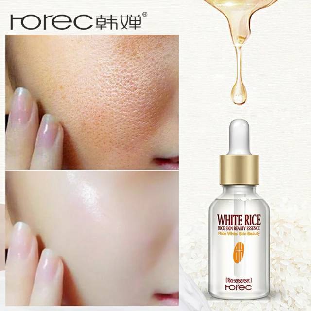 

Horec