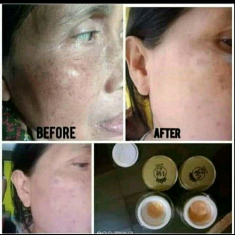 

Gold gel