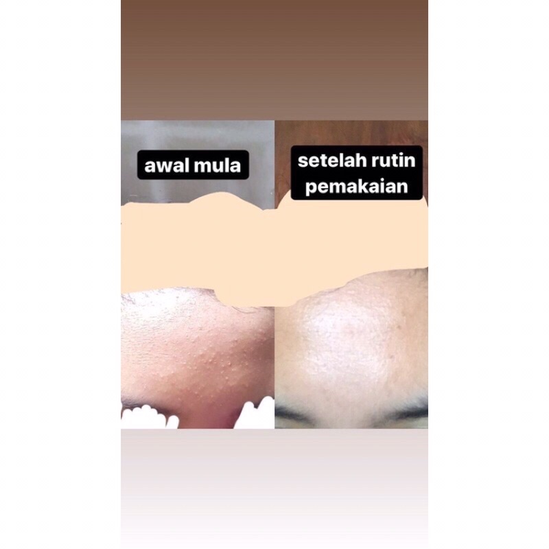 BPOM Camille product 25gr - 65gr (baca deskripsi)-8