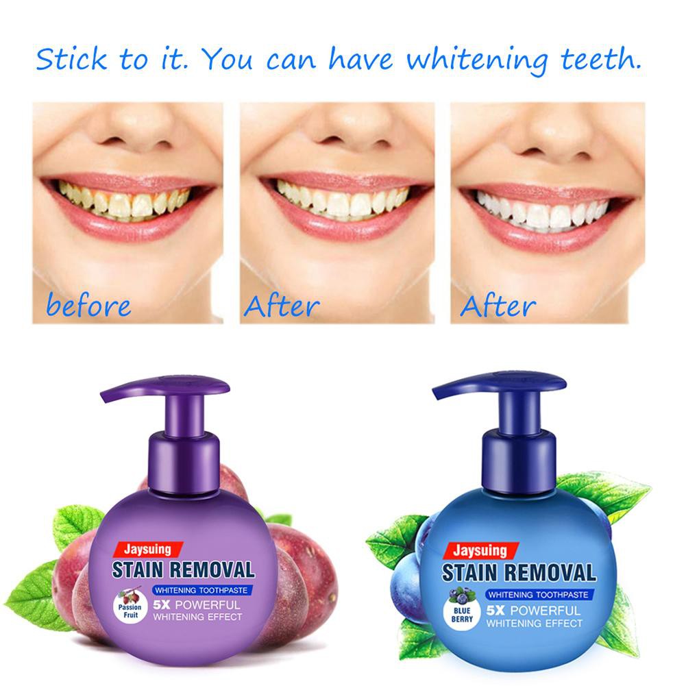 Intensive Stain Removal Whitening Toothpaste Fight Bleeding Gums For Teeth Baking Soda Refreshing Shopee Indonesia