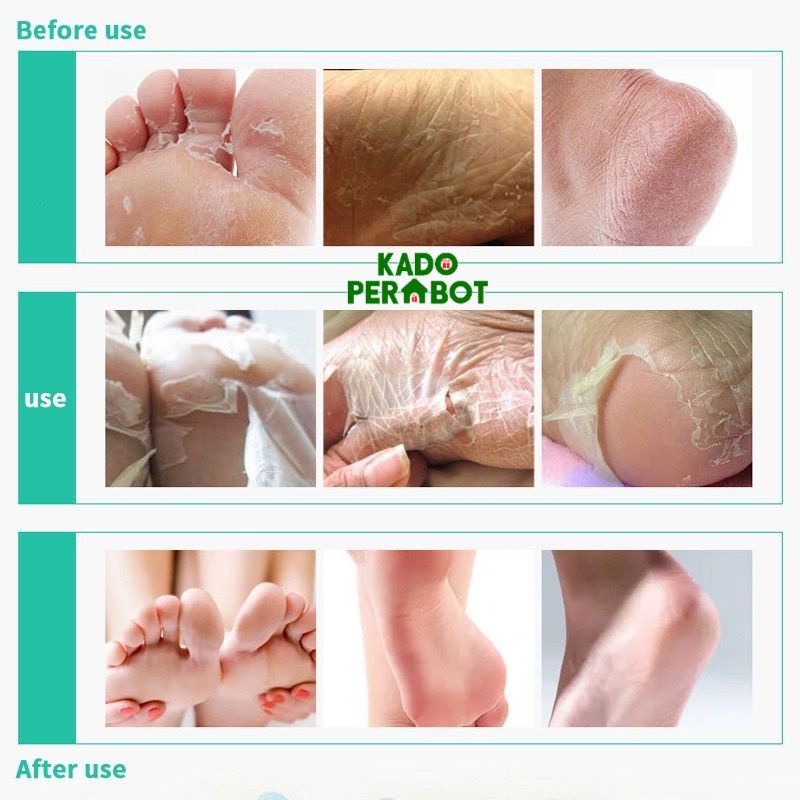 efero hand mask - masker penglupas kulit kaki - masker kulit kaki