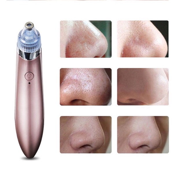 ALAT PENYEDOT KOMEDO JERAWAT / COMEDO BLACKHEAD REMOVER SUCTION