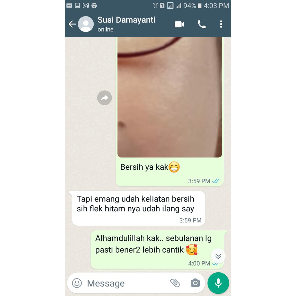 REGLOW Facial Wash Sabun Pembersih Wajah | Paket Perawatan Kecantikan Muka Glowing Glow | Atasi Jerawat Flek Hitam Milia Kusam | Skincare Skin Care BPOM Halal MUI | Sunscreen Whitening Anti-Aging | Aman Bumil Busui-5