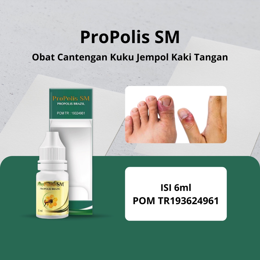 Jual Propolis Sm Obat Cantengan Kuku Jempol Kaki Bengkak Bernanah Bau