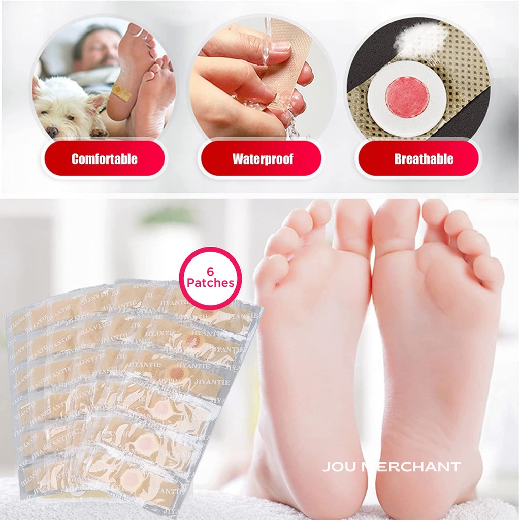 Plester Kutil dan Mata Ikan / Kapalan / Callus Remover / Obat Kulit Kaki dan Tangan SATUAN