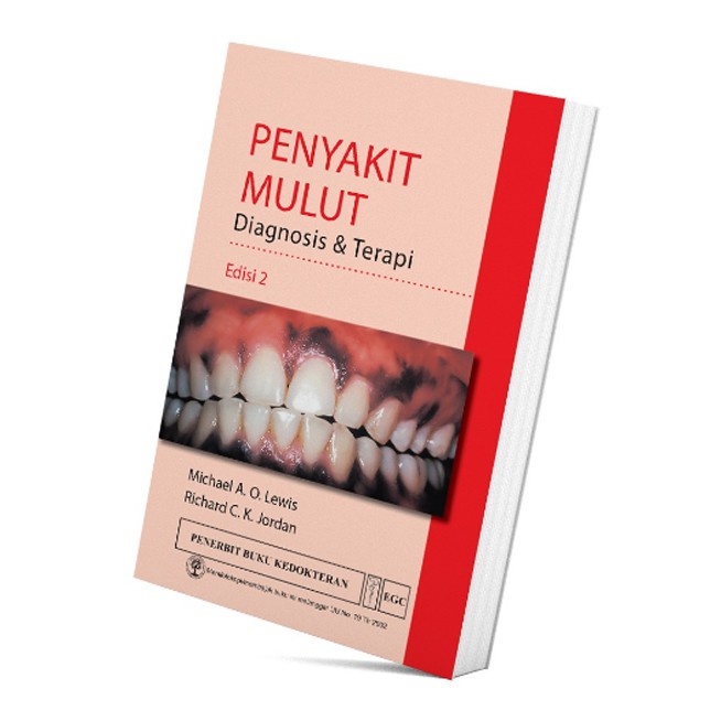 Penyakit Mulut Diagnosis & Terapi Edisi 2 - Michael A.O. Lewis & Richard C.K. Jordan