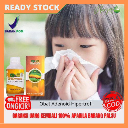 Obat Herbal Adenoid, Adenoid Hipertrofi, Pembengkakan Saluran Hidung Anak,  Kelenjar Getah Bening Di