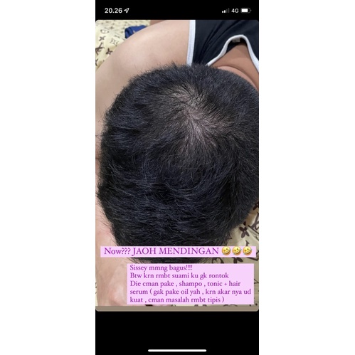 SISSEY SERUM HAIR GROWTH ( beli 4 mixed sissey free gift )