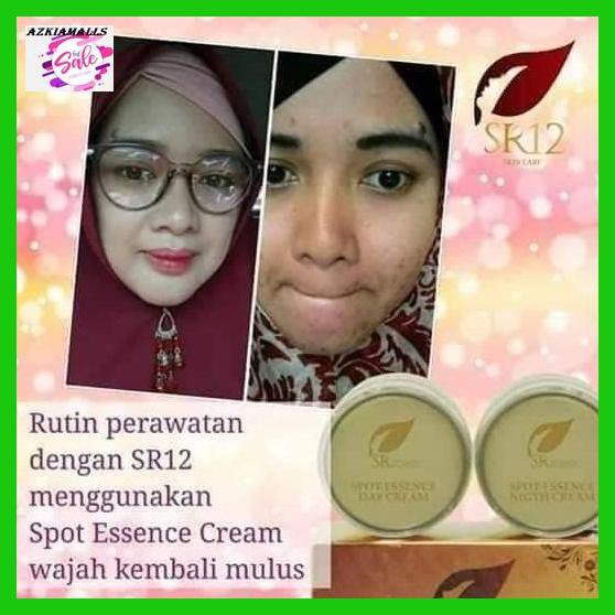 

Tekapwajah- Spot Essence Day & Night Cream Sr12 Bpom - Harga Distributor -Asliii.