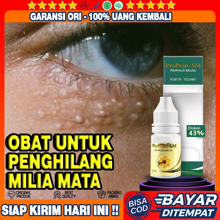 Obat Milia Di Mata, Obat Perontok Milia, Obat Penghilang Milia Mata, Obat Tetes Milia Wajah Propolis