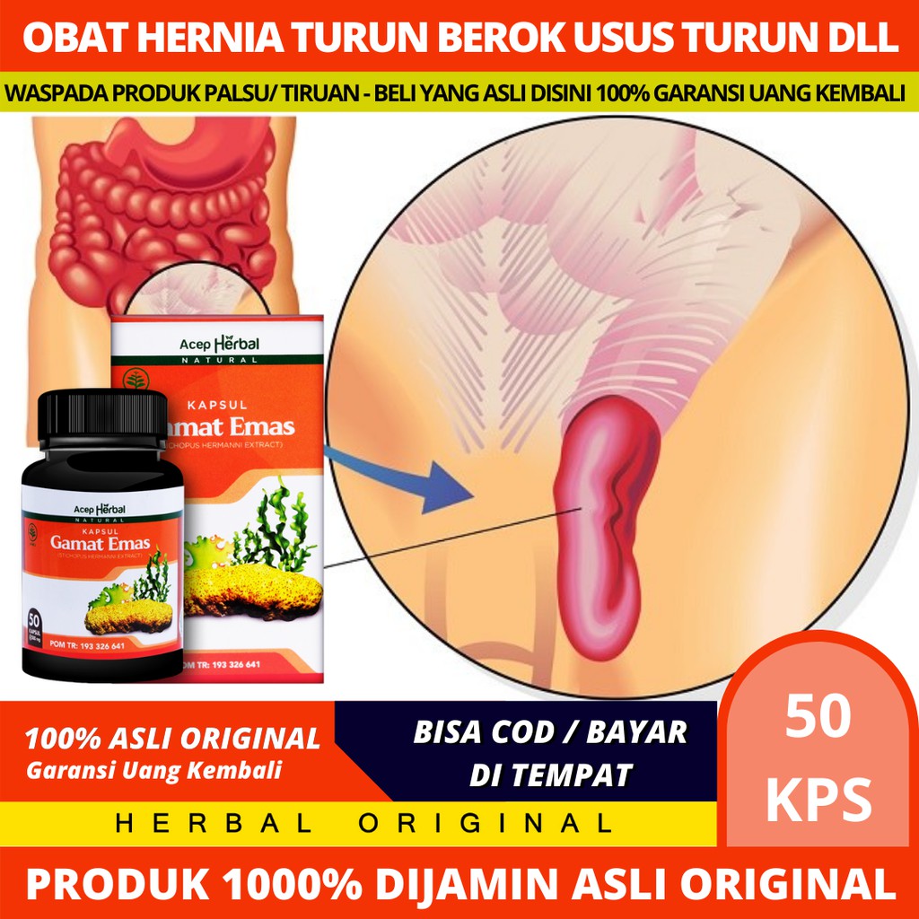 Obat Sakit Usus Turun Yang Sudah ParahDengan Kapsul Gamat Emas Acep Herbal 100% Original