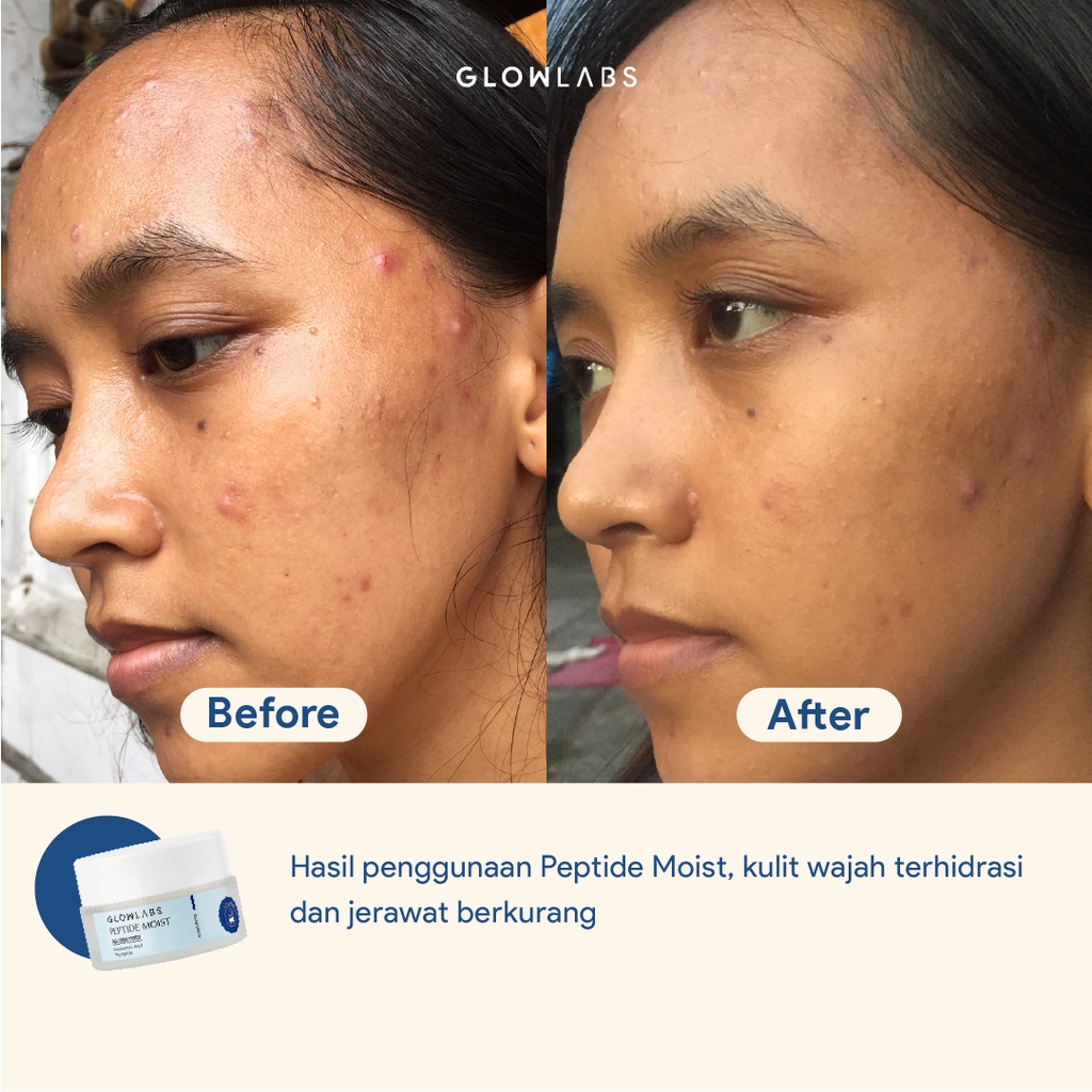 GLOWLABS Peptide Moist 20gr &amp; 40gr - Moisturizer untuk Melembabkan Wajah