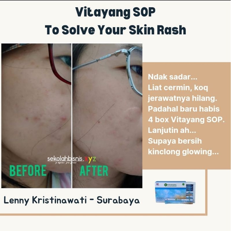 Vitayang SOP ( Salmon Ovary Peptide )