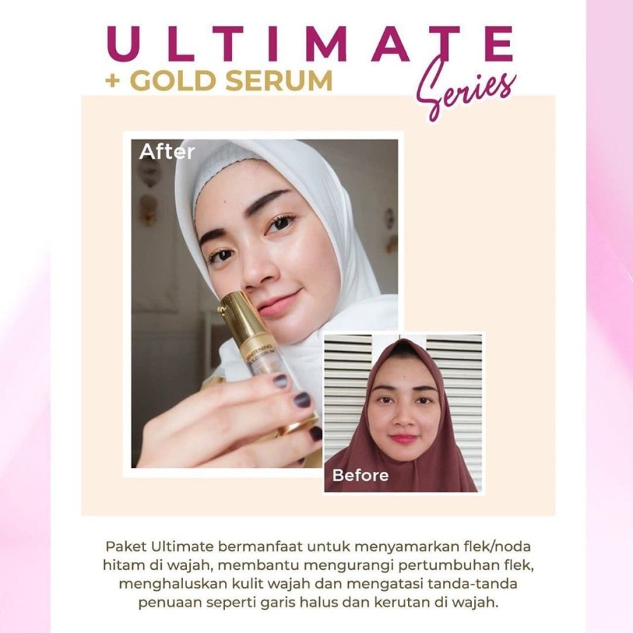 Ms Glow Paket Ultimate Series Free Pouch / Cream Penghilang Flek