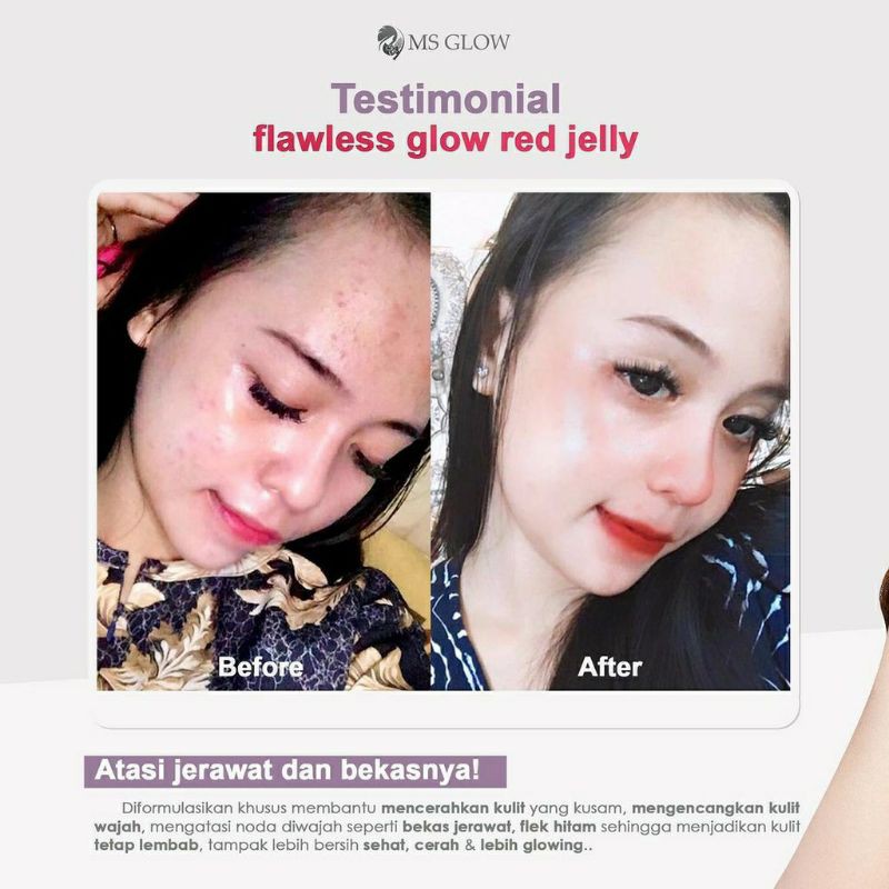 [COD] MS GLOW PAKET WAJAH/+ SERUM [SERUM TERJUAL TERPISAH DARI PAKET WAJAH]