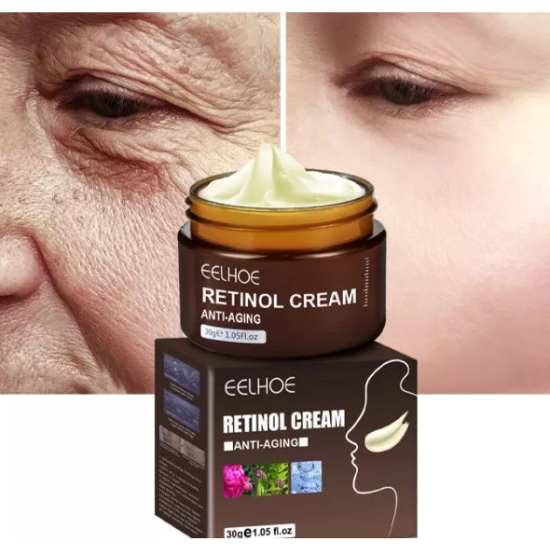 EELHOE CREAM RETINOL TERLARIS Pengencangan wajah memutihkan anti oksidan