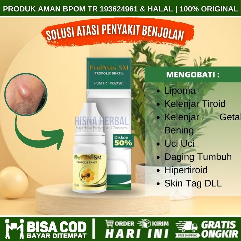 Obat Hancurkan Benjolan Di Tulang Punggung, Salep Oles Penghancur Tumor Jinak Di Ketiak, Menghancurk