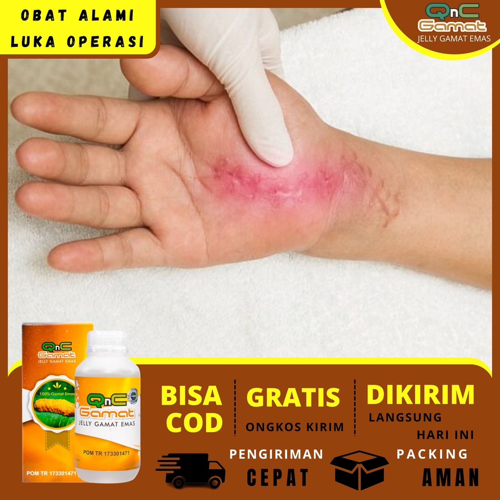 Jual Obat Pengering Luka Pasca Operasi Caesar Luka Bekas Operasi