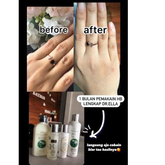 Ella skincare HB pemutih lengkap