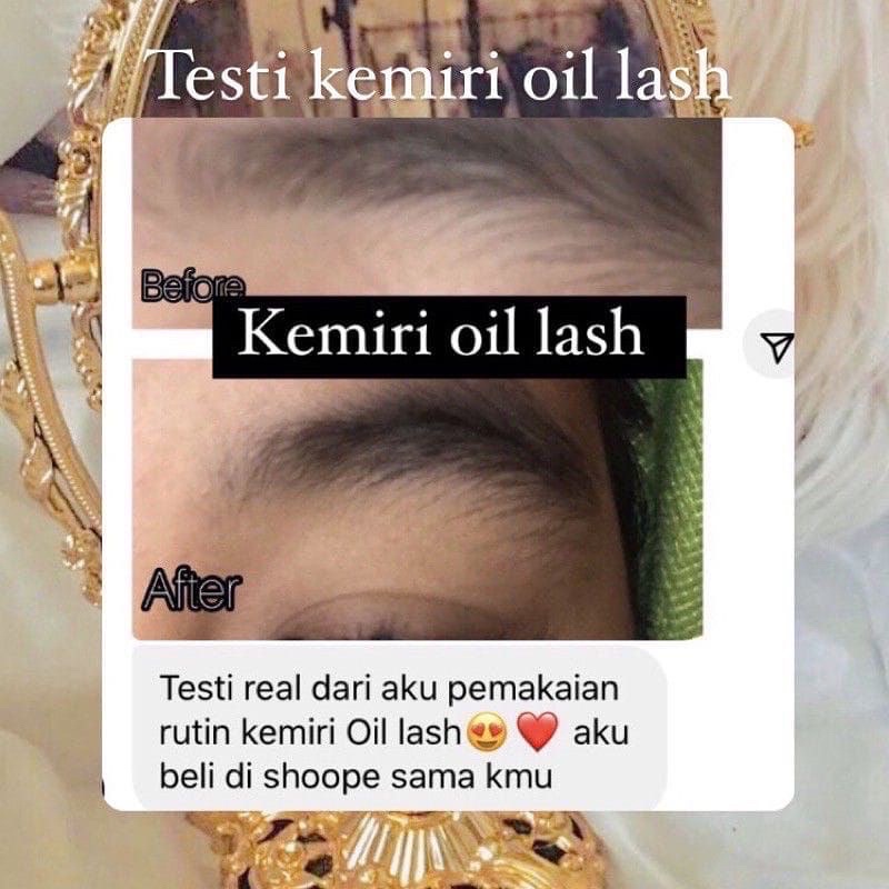 [ READY STOCK ] KEMIRI OIL LASH | SERUM PELEBAT ALIS DAN BULU MATA | MINYAK KEMIRI ASLI