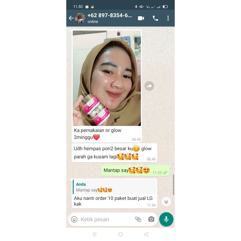 CREAM FLEK NRGLOW RJNSKIN CREAM JERAWAT CREAM KULIT SUSAH PUTIH FLEK TEBAL(AMPUH)