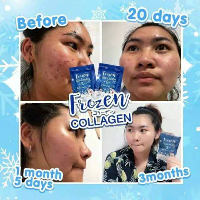 Frozen Collagen 2 in 1 Whitening X10