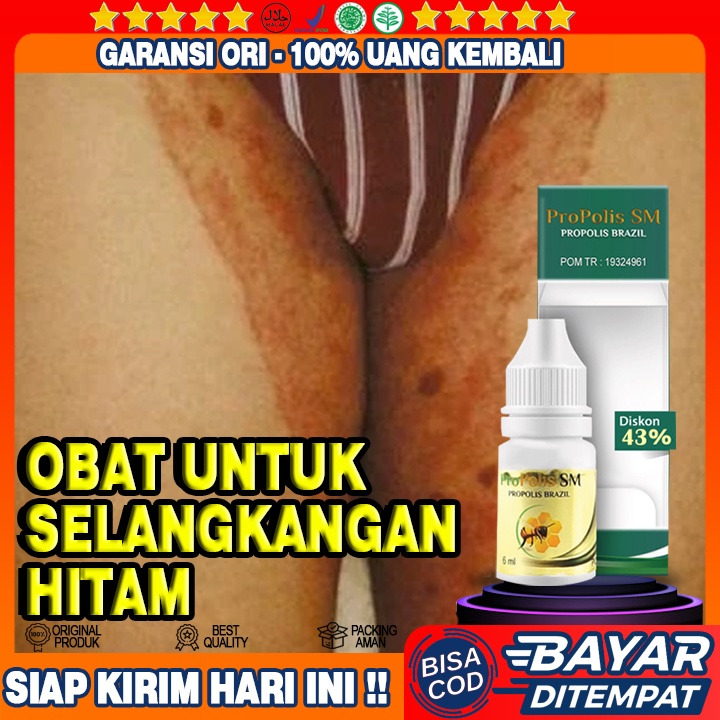 Obat Selangkangan Hitam, Obat Gatal Selangkangan, Obat Gatal Kelamin, Obat Gatal Gatal Pada Kulit,