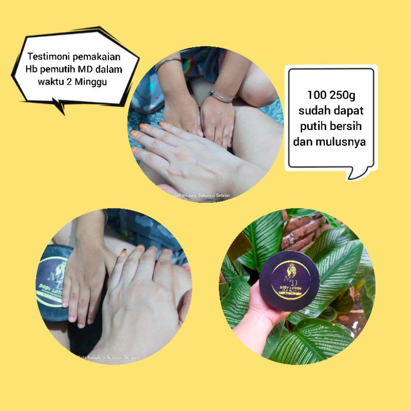 body_lotion_MD_whitening_dosting