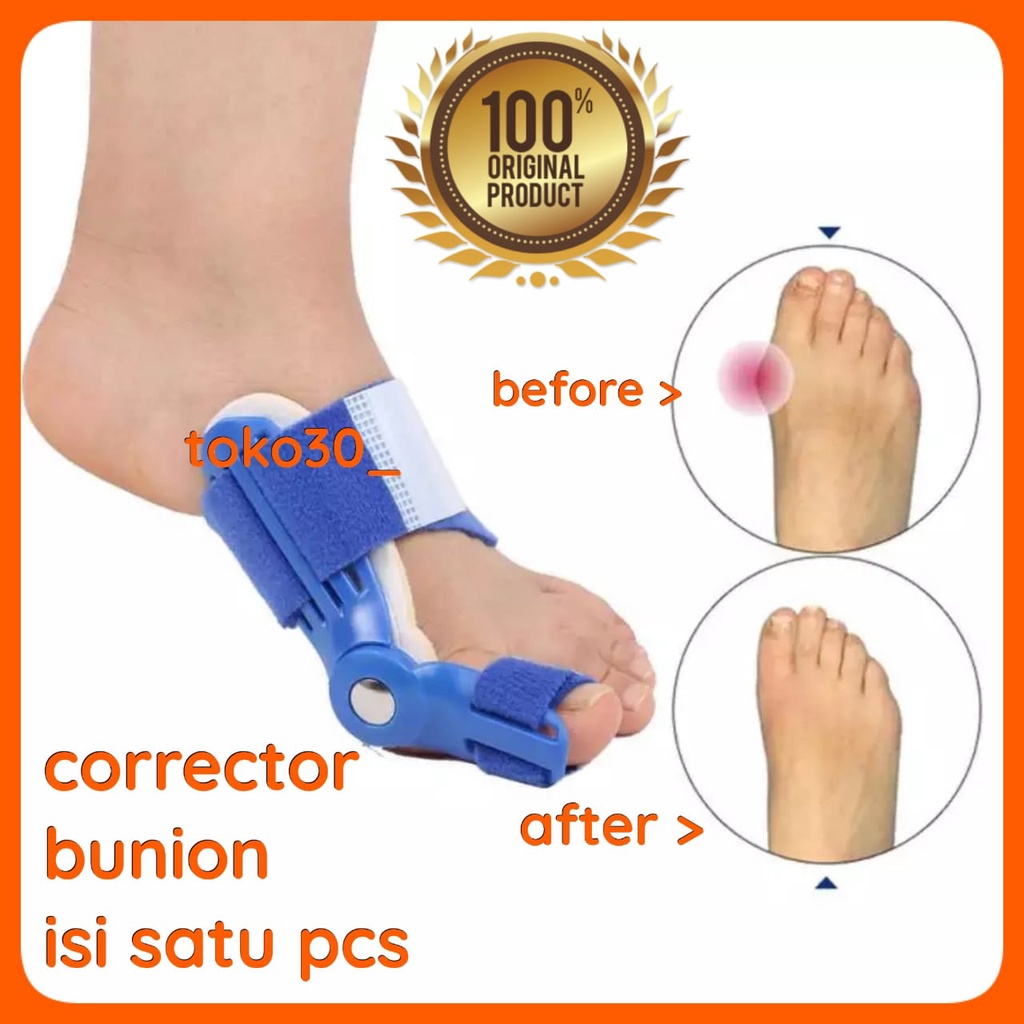 PREMIUM QUALITY BUNION CORRECTOR HALLUX VALGUS SPLINT TERAPI KAKI BUNION JARI KAKI BENGKOK MEMPERBAIKI BENTUK JARI KAKI