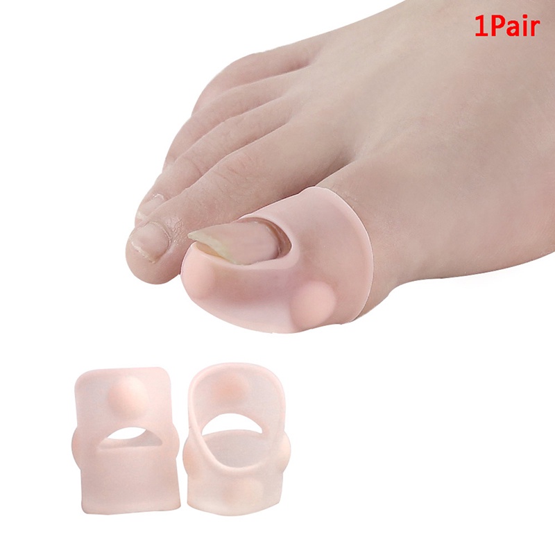 (Happy) 1 Pasang Separator Jari Kaki Bahan Silikon Untuk Bunion / Hallux Valgus