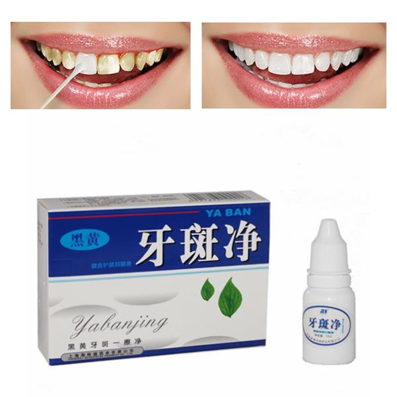 Yabanjing Whitening teeth : Pemutih Gigi : Bleaching tooth : cairan pembersih gigi berbehel &amp; tidak - Alat bahan Penghilang Pembersih plak karang gigi ampuh