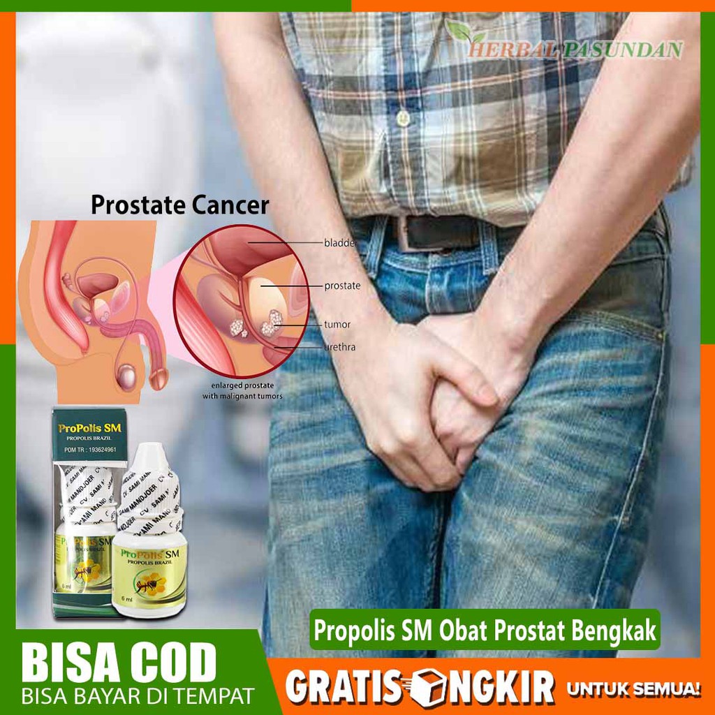 

OBAT RADANG PROSTAT, PROSTAT BENGKAK, VARIKOKEL HERBAL - PROPOLIS SM BRAZILIAN ASLI YOGYAKARTA