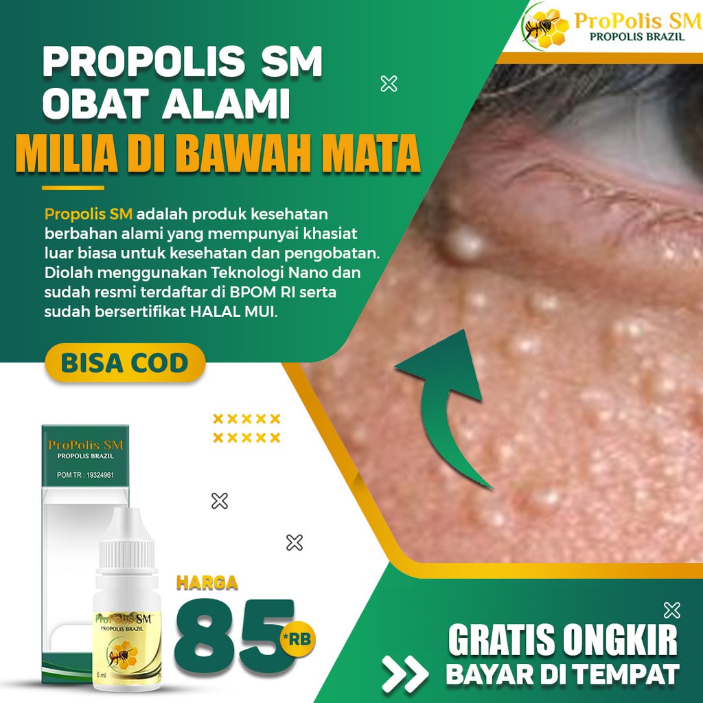 Obat Milia di Mata, Penghilang Milia di Wajah, Bruntusan Di Wajah, Propolis sm Murah hilangkan milia