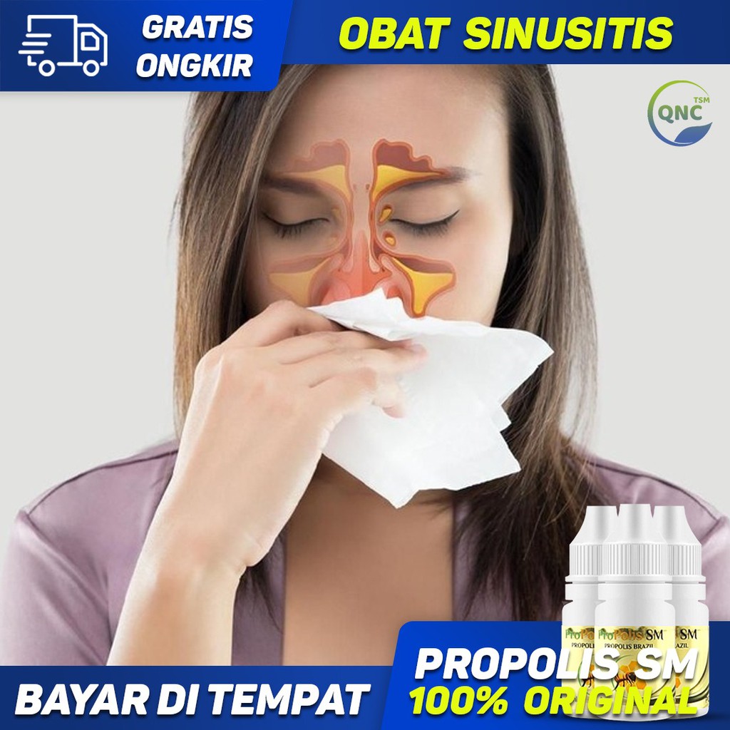 Obat Sinusitis, Sinus, Sinusitis Akut, Sinusitis Kronis, Sinusitis Kambuhan - Propolis SM