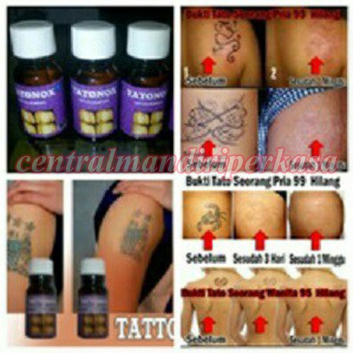Cairan Penghilang Tato Obat Penghilang Tato Pembersih Tato Penghilang Tatto Tatonox Penghilang Tato
