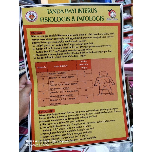 

POSTER TANDA BAYI IKTERUS FISIOLOGIS DAN PANTATOLOGUS (73)