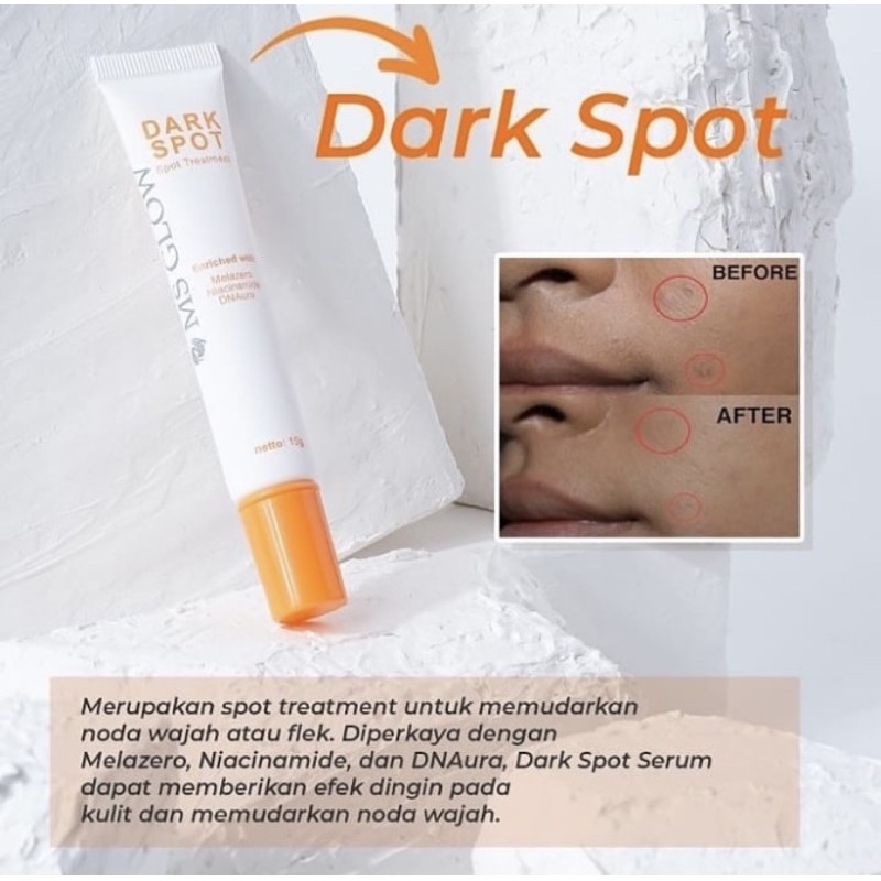 Dark spot serum ms glow