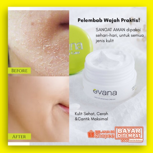 Wajib Konsul Moisturizing Cream Evana Pelembab Super Lembut Dan Halus Diwajah Mengatasi Kulit Kering Shopee Indonesia