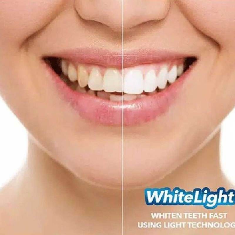 Beauty Jaya - Pemutih Gigi White Light WhiteLight Whitening Teeth - Perawatan Pembersih Gigi Kuning