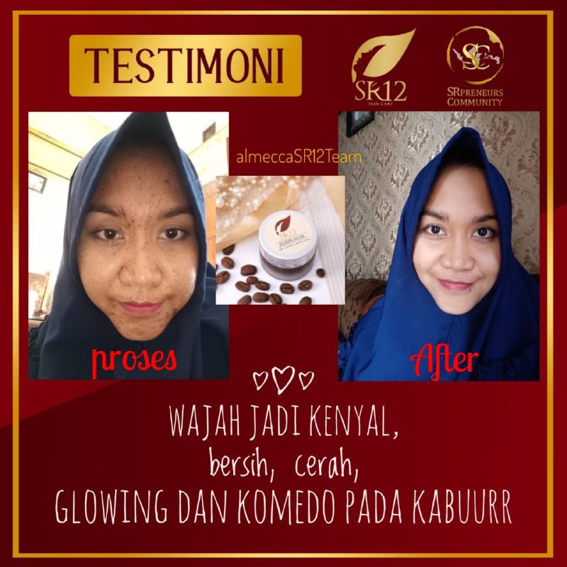 COFFEE MASK SR12 PEELING NATURAL / MASKER PEELING KOPI MENGATASI KOMEDO FLEK HITAM BEKAS JERAWAT