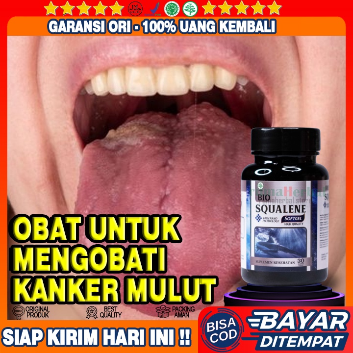 Obat Kanker Mulut - Obat Kanker Mulut Alami - Obat Lidah Bercak Putih - Obat Lidah Pecah Pecah - Oba