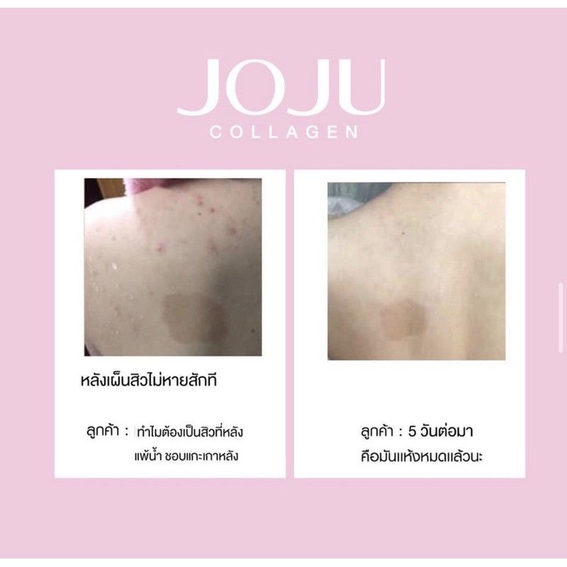 ‼️READY‼️JOJU COLLAGEN ISI 30 KAPSUL (BERSERTIFIKAT)