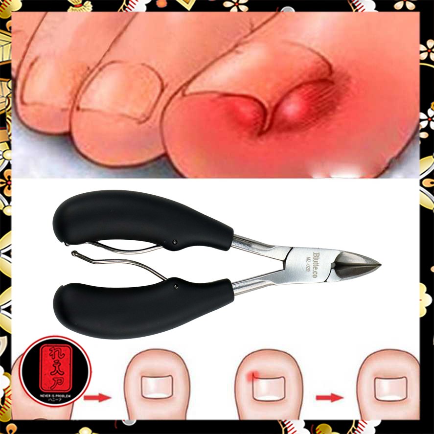 Gunting Kuku Jempol Kaki Anti Cantengan Toe Nail Clipper - MZ-020 - Black