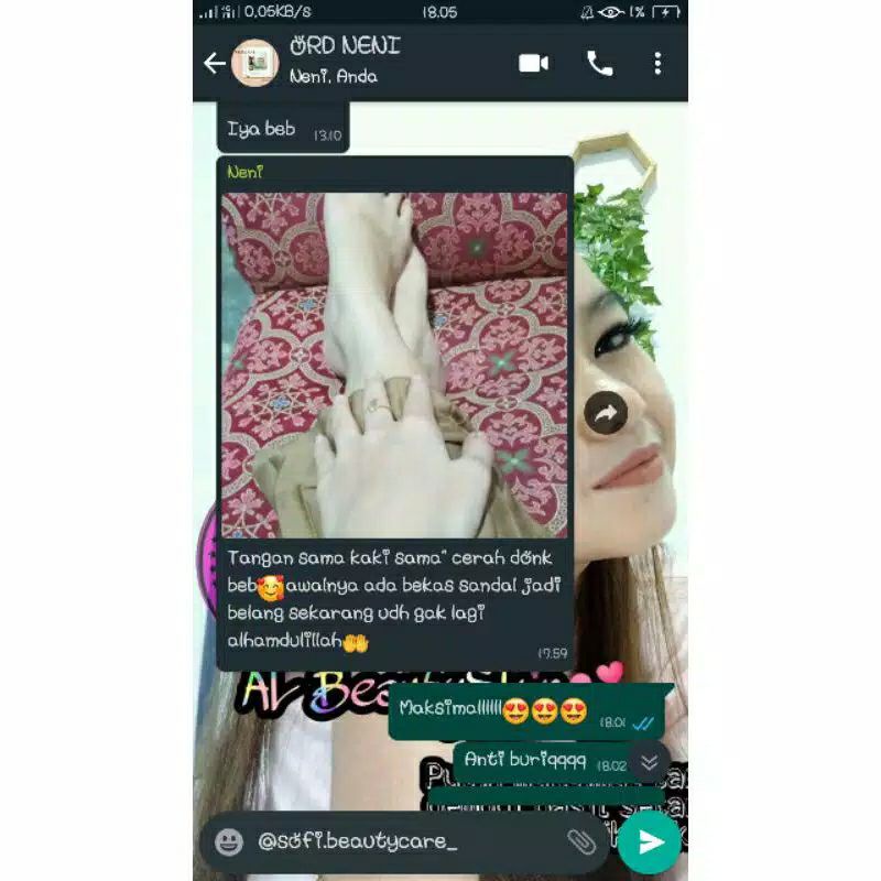 Bibit Whitening Al Beautyskin