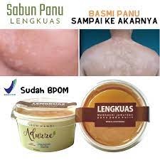 Sabun Anti Jamur Kulit - Sabun Lengkuas Penghilang Panu Obat Panu Anak Ampuh Obat Gatal Selangkangan